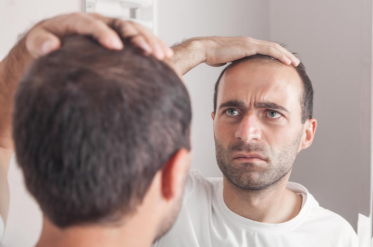 Alopecia: Compreendendo as Causas, Sintomas e Opções de Tratamento